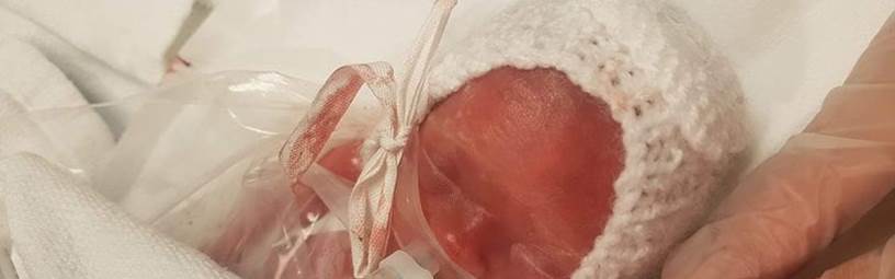Baby born size of chocolate bar home for Christmas Baby born size of chocolate bar home for Christmas