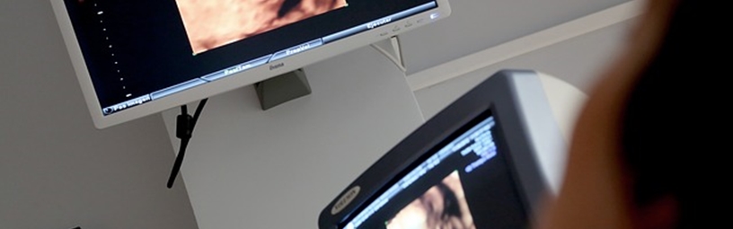 Ultrasound Ultrasound