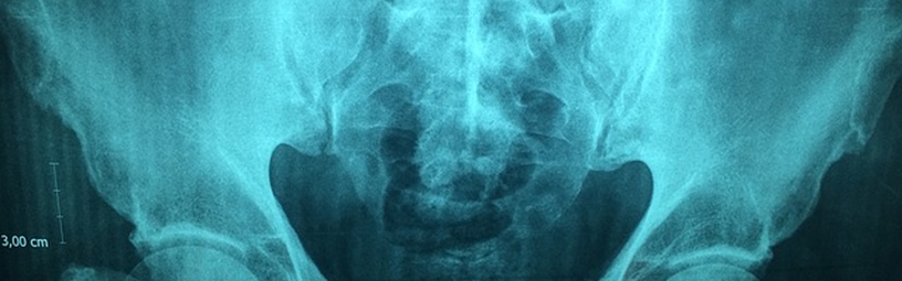 Interventional Radiology Interventional Radiology