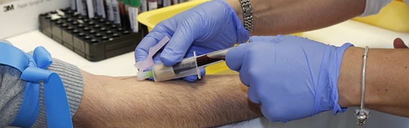 Blood Testing Blood Testing